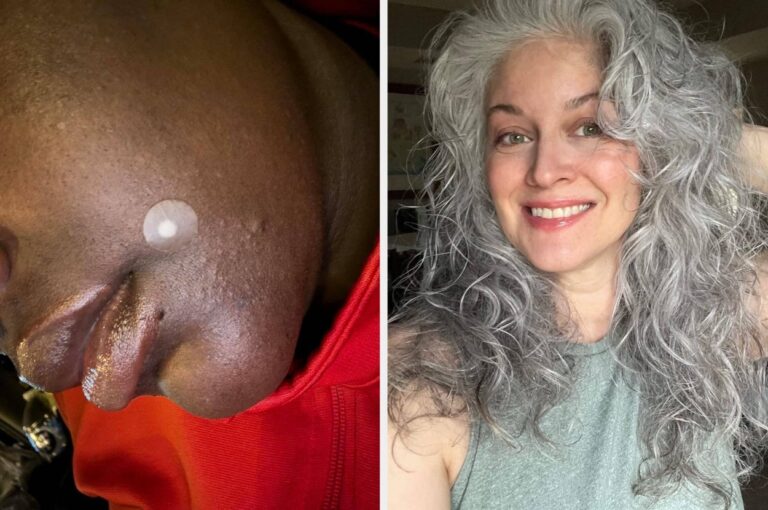 Acne Patches, Purple Shampoo And 26 Other Beauty Products That May Seem Sus, But Actually Work
