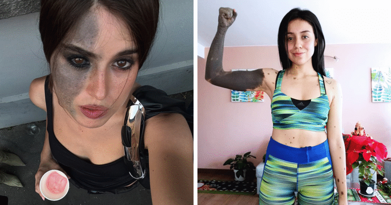 67 People Share Their Amazing And Interesting Birth Marks