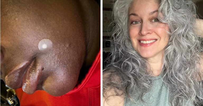 Acne Patches, Purple Shampoo And 25 Other Beauty Products That May Seem Sus, But Actually Work