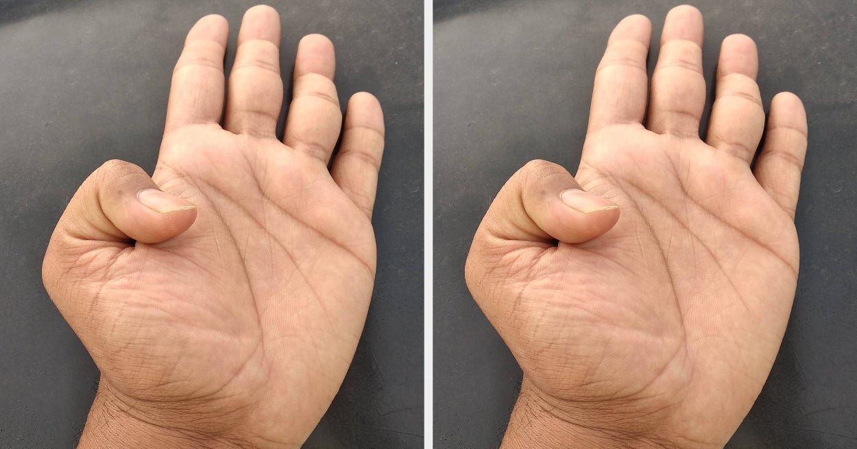 This 2-Second Thumb Test Could Indicate If You're At Risk For A Heart Problem