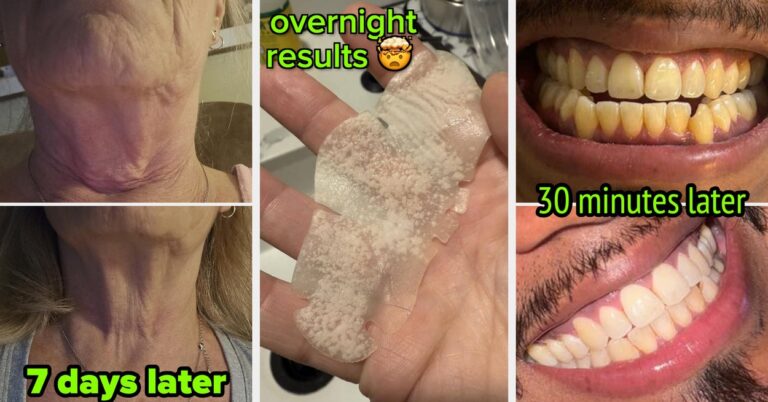 33 Before And Afters That Prove These 33 Body Care Products *Actually* Work