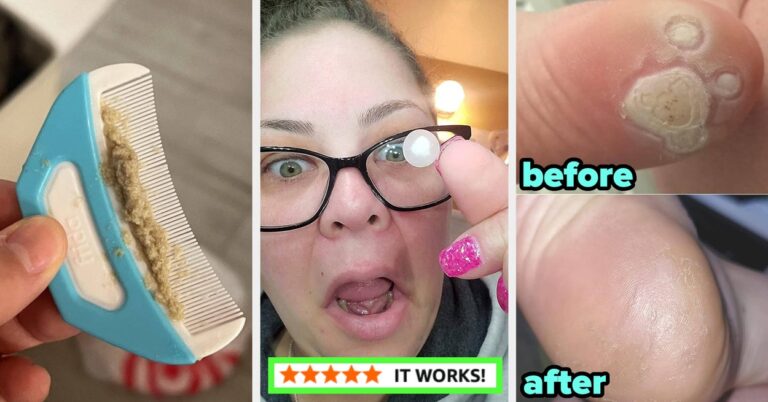 30 Products That Prove You’re Not The Only One Dealing With Kinda Embarrassing Body Issues