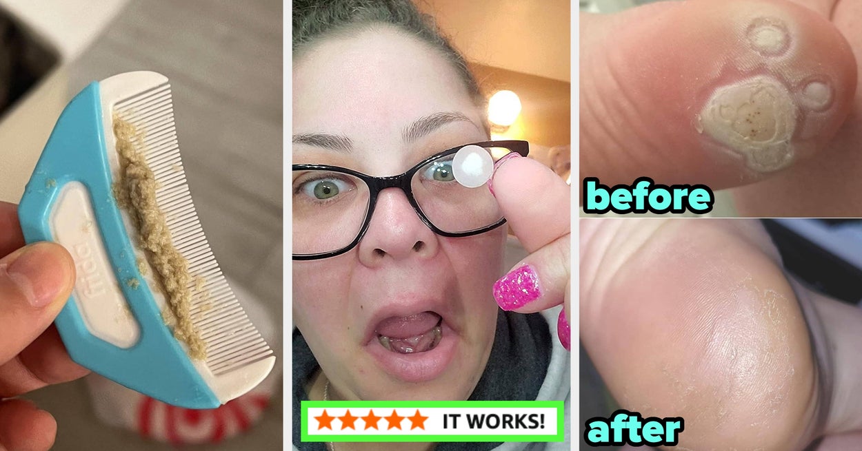 30 Products That Prove You’re Not The Only One Dealing With Kinda Embarrassing Body Issues