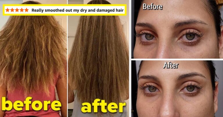 31 Beauty Products With "Before" Pictures To Show How Effective They Are