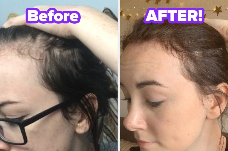 34 Items To Quietly Help Solve Those Awkward Body Problems You Tend To Keep To Yourself