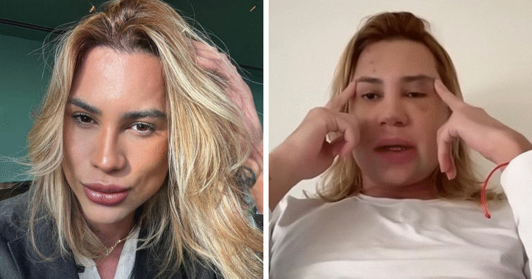 Influencer Passes Away After Exposing Complications From Popular ‘Fox Eyes’ Surgery