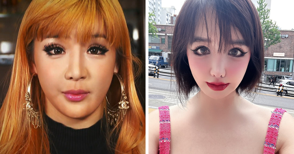 K-Pop Icon Park Bom Reveals Heartbreaking Reason Behind Drastic Plastic Surgery Transformation