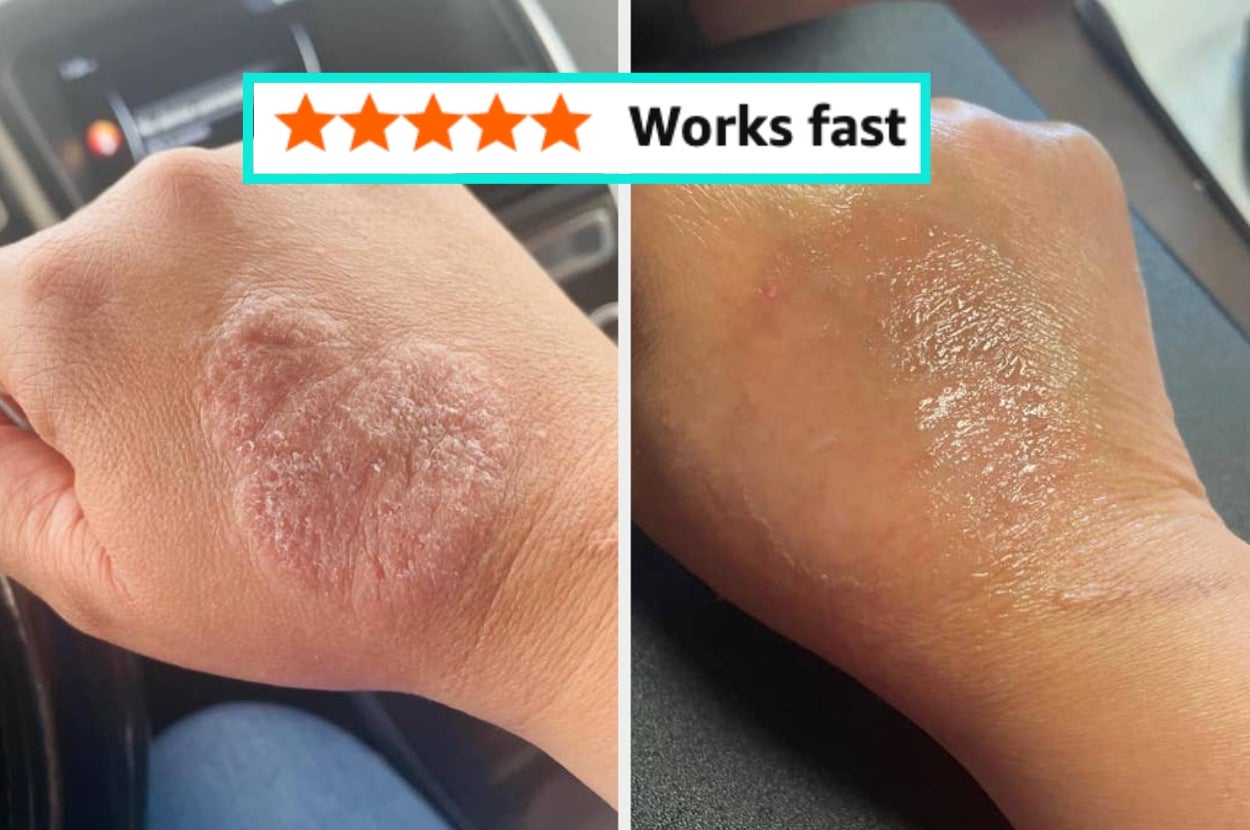 32 Beauty Items With Such Jaw-Dropping Results, You’ll Be Fully Convinced A Witch Invented Them