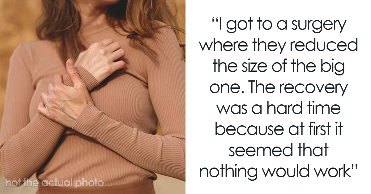 22 Worst Stories Of Botched Plastic Surgeries People Sadly Experienced