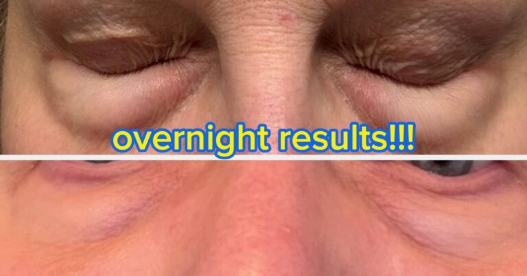 20 Under $10 Skincare Finds That Are Worth Their Weight In Gold